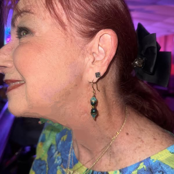 The gorgeous earrings. Love!